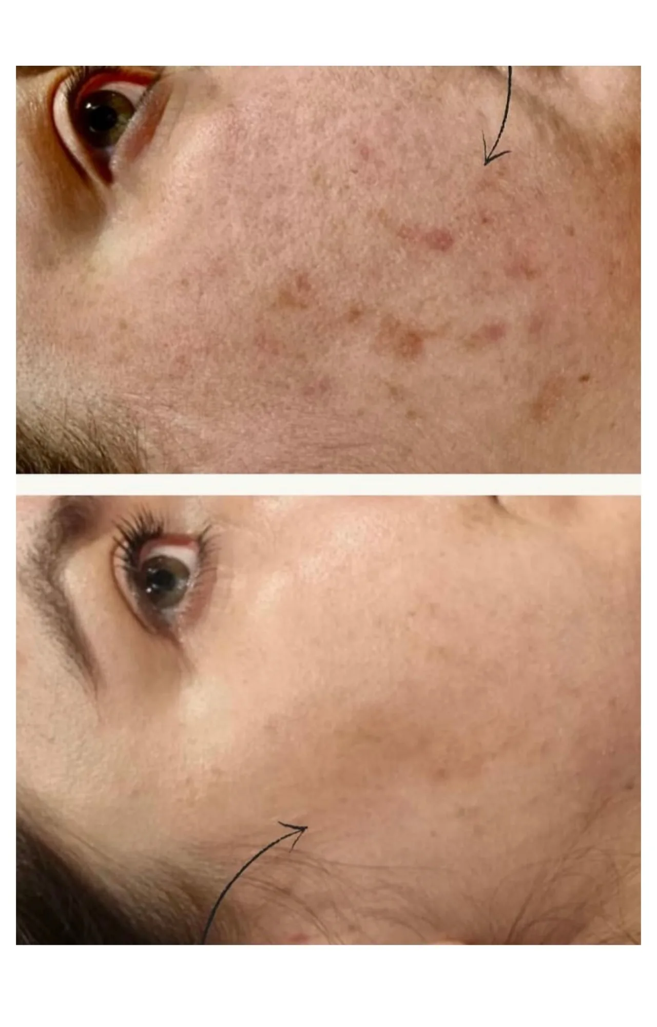 Transformation 1
