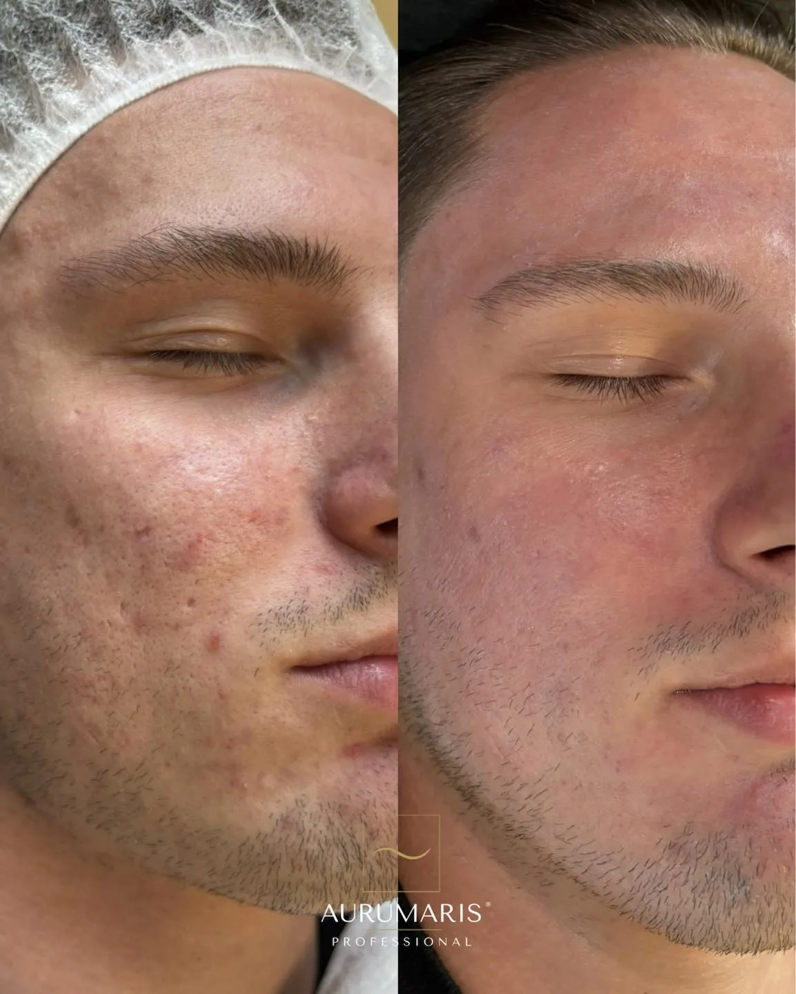 Transformation 2
