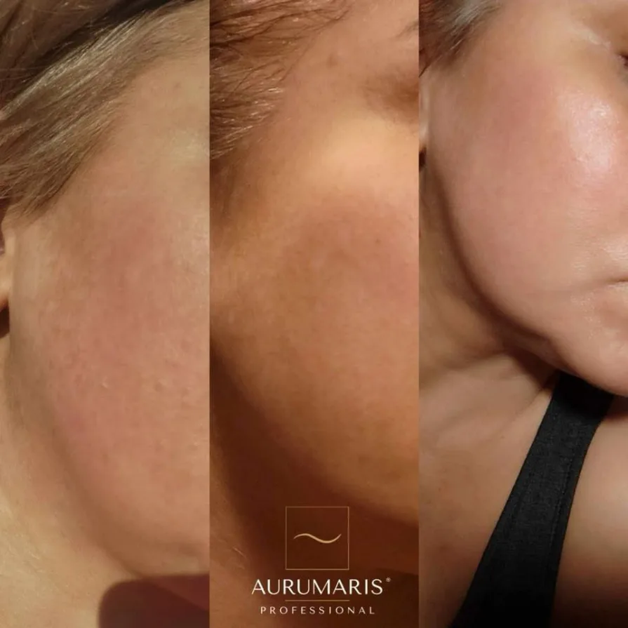Efficacité soins augmentée